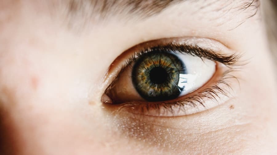 Understanding Eye Redness: What You Need to Know 8 abcdhe 331