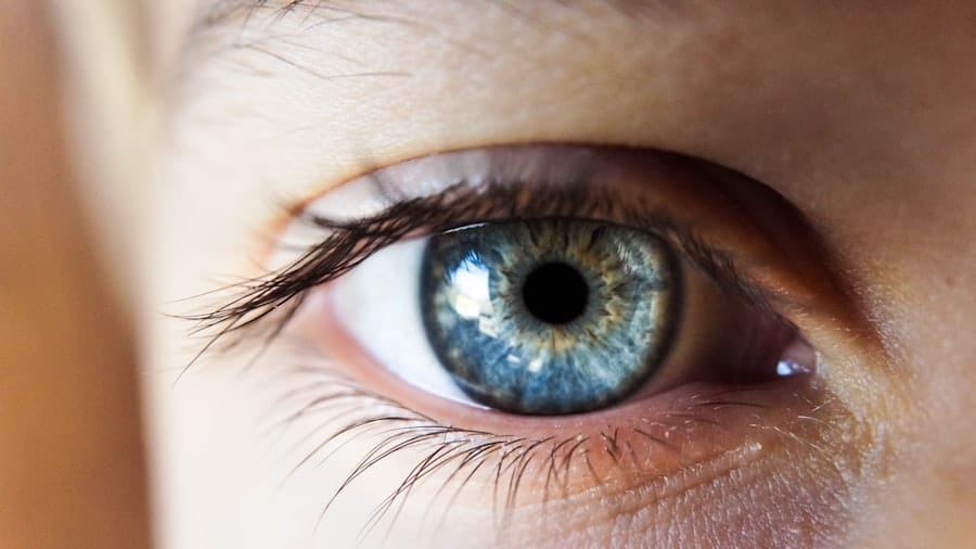 Understanding Eye Redness: What You Need to Know 9 image 667